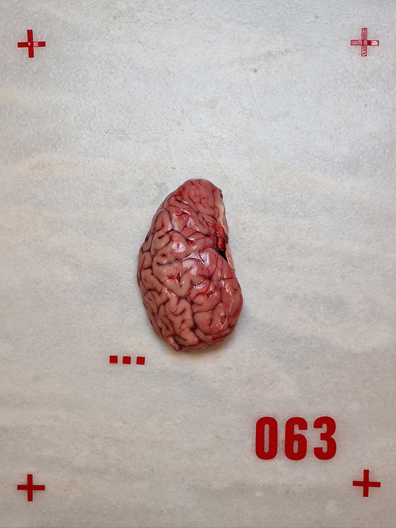 01-CEREBRO